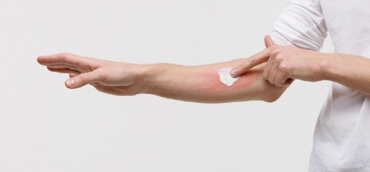Jak powinna wyglądać pielęgnacja cery przy atopowym zapaleniu skóry?